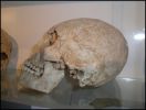 Crâne wisigoth volontairement déformé